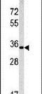 Emerin antibody, PA5-13457, Invitrogen Antibodies, Western Blot image 