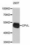 Carboxypeptidase Vitellogenic Like antibody, STJ26863, St John