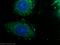 Mitochondrial Carrier 2 antibody, 16888-1-AP, Proteintech Group, Immunofluorescence image 