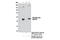 pp60c-src antibody, 12432S, Cell Signaling Technology, Immunoprecipitation image 