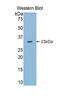 Toll Like Receptor 5 antibody, LS-C300227, Lifespan Biosciences, Western Blot image 