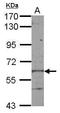 Kelch Like Family Member 28 antibody, GTX122694, GeneTex, Western Blot image 