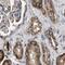 Translational Activator Of Cytochrome C Oxidase I antibody, PA5-54479, Invitrogen Antibodies, Immunohistochemistry paraffin image 