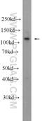 Sickle tail protein homolog antibody, 24880-1-AP, Proteintech Group, Western Blot image 