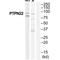 Protein Tyrosine Phosphatase Non-Receptor Type 22 antibody, A00581, Boster Biological Technology, Western Blot image 