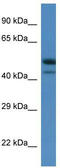 SH3 Domain Binding Kinase 1 antibody, TA346690, Origene, Western Blot image 
