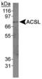 Acyl-CoA Synthetase Long Chain Family Member 1 antibody, PA5-22888, Invitrogen Antibodies, Western Blot image 