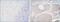 Aldehyde Dehydrogenase 1 Family Member A1 antibody, GTX82775, GeneTex, Immunohistochemistry paraffin image 