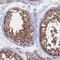 Cytokine Induced Apoptosis Inhibitor 1 antibody, NBP1-89096, Novus Biologicals, Immunohistochemistry paraffin image 