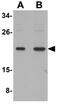 Small ubiquitin-related modifier 3 antibody, GTX31805, GeneTex, Western Blot image 