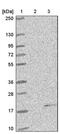 Nuclear Transport Factor 2 antibody, PA5-59350, Invitrogen Antibodies, Western Blot image 