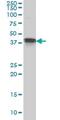 Muscleblind Like Splicing Regulator 1 antibody, ab77017, Abcam, Western Blot image 