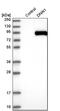 Dynein Axonemal Intermediate Chain 1 antibody, PA5-54482, Invitrogen Antibodies, Western Blot image 