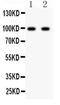 Glutamate Ionotropic Receptor AMPA Type Subunit 2 antibody, PA5-79326, Invitrogen Antibodies, Western Blot image 