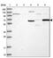 T-Complex 11 Like 2 antibody, PA5-58807, Invitrogen Antibodies, Western Blot image 