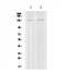 Pleckstrin And Sec7 Domain Containing antibody, PA5-79889, Invitrogen Antibodies, Western Blot image 