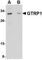 Growth Hormone Regulated TBC Protein 1 antibody, NBP1-76376, Novus Biologicals, Western Blot image 