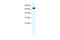 Ring Finger Protein 112 antibody, 28-009, ProSci, Western Blot image 