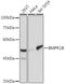 Bone Morphogenetic Protein Receptor Type 1B antibody, GTX32474, GeneTex, Western Blot image 