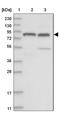 Tudor Domain Containing 1 antibody, NBP1-84349, Novus Biologicals, Western Blot image 