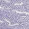 Acid Phosphatase, Prostate antibody, NBP2-39012, Novus Biologicals, Immunohistochemistry paraffin image 