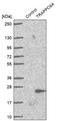 Trafficking Protein Particle Complex 6A antibody, HPA043043, Atlas Antibodies, Western Blot image 