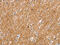 Solute carrier family 2, facilitated glucose transporter member 3 antibody, CSB-PA780302, Cusabio, Immunohistochemistry paraffin image 