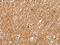 Solute Carrier Family 2 Member 3 antibody, CSB-PA780302, Cusabio, Immunohistochemistry paraffin image 