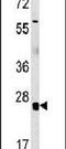 RNA Binding Motif Protein 24 antibody, PA5-25520, Invitrogen Antibodies, Western Blot image 