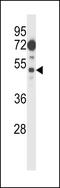 FLT3 Interacting Zinc Finger 1 antibody, 57-085, ProSci, Western Blot image 