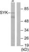 Spleen Associated Tyrosine Kinase antibody, LS-C117582, Lifespan Biosciences, Western Blot image 