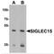 Sialic Acid Binding Ig Like Lectin 15 antibody, MBS150636, MyBioSource, Western Blot image 