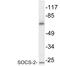 Suppressor Of Cytokine Signaling 2 antibody, LS-C200007, Lifespan Biosciences, Western Blot image 
