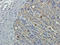 Glypican 3 antibody, orb10735, Biorbyt, Immunohistochemistry paraffin image 
