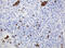 CNKSR Family Member 3 antibody, M13481, Boster Biological Technology, Immunohistochemistry paraffin image 
