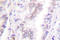 Cyclin Dependent Kinase 7 antibody, LS-C176335, Lifespan Biosciences, Immunohistochemistry paraffin image 