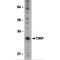 Toll Like Receptor Adaptor Molecule 2 antibody, MBS151076, MyBioSource, Western Blot image 