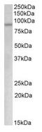 MYB Proto-Oncogene, Transcription Factor antibody, AP20174PU-N, Origene, Western Blot image 