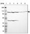 Ubiquitin Specific Peptidase 51 antibody, NBP1-86167, Novus Biologicals, Western Blot image 