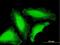 TATA-Box Binding Protein Associated Factor 8 antibody, H00129685-B01P, Novus Biologicals, Immunocytochemistry image 