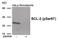 BCL2 antibody, 79-992, ProSci, Western Blot image 