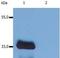 Lck Interacting Transmembrane Adaptor 1 antibody, MA1-19367, Invitrogen Antibodies, Western Blot image 