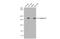 Collagen Type III Alpha 1 Chain antibody, GTX111643, GeneTex, Western Blot image 