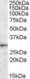 Triggering Receptor Expressed On Myeloid Cells 2 antibody, orb20251, Biorbyt, Western Blot image 