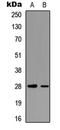 Troponin I3, Cardiac Type antibody, LS-C358887, Lifespan Biosciences, Western Blot image 