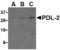 Programmed Cell Death 1 Ligand 2 antibody, AHP1704, Bio-Rad (formerly AbD Serotec) , Western Blot image 