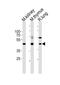Delta Like Non-Canonical Notch Ligand 1 antibody, A00513-4, Boster Biological Technology, Western Blot image 