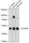 Solute Carrier Family 30 Member 6 antibody, 14-081, ProSci, Western Blot image 