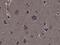 Ribosomal Protein S6 Kinase A1 antibody, P01058-3, Boster Biological Technology, Immunohistochemistry paraffin image 