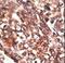 Matrix Metallopeptidase 13 antibody, LS-C100443, Lifespan Biosciences, Immunohistochemistry paraffin image 